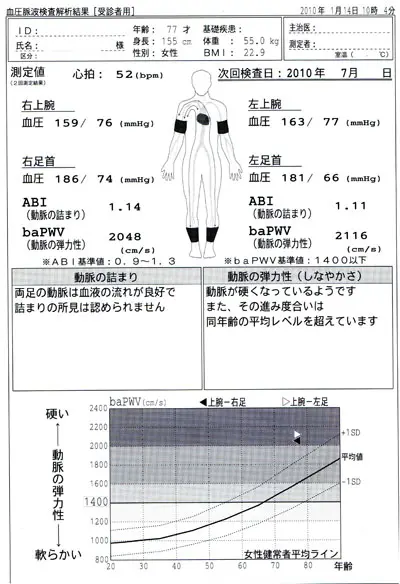 血管の硬さ表示タイプ｜1の用紙について｜検査結果の見方｜血圧脈波検査装置｜製品情報｜フクダコーリン株式会社｜医療機器・システムの企画販売