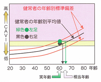 血圧脈波検査 | 疾患・検査・治療 | 【公式】医療法人川崎病院