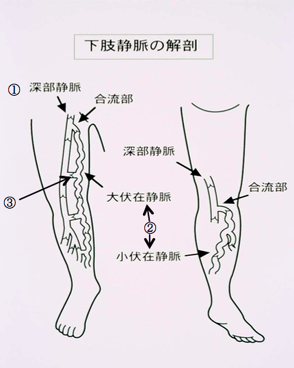 血管外科（下肢静脈瘤・むくみ）｜西川口｜きむら内科外科クリニック｜ 下肢静脈瘤 胃カメラ