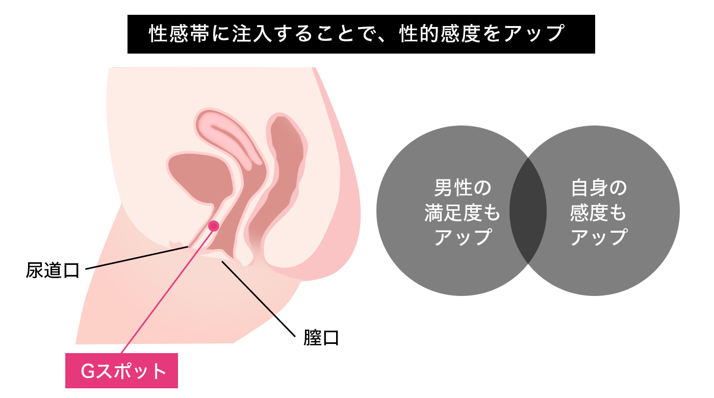 ポルチオとは？産婦人科専門医の丹羽咲江医師が子宮腟部を徹底解説します。 | 腟ペディア