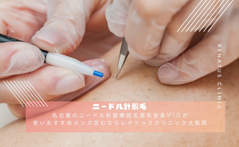 大阪の脱毛サロンで40代50代60代の白髪VIO脱毛を体験しよう！｜Pinsia 電気脱毛・白髪脱毛専門店 大阪