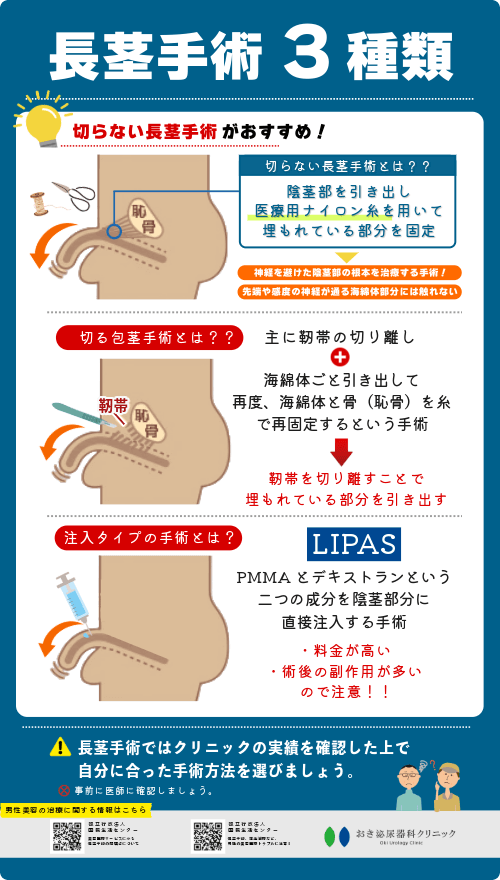 長茎手術に後悔しないポイントは？失敗のリスクと後遺症からクリニック選びのポイントを解説 | 包茎治療について｜おき泌尿器科クリニック｜富田林市の泌尿器科