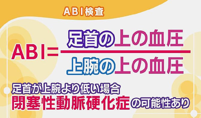 ふくおか クリニック | こんにちは。ふくおかクリニックです🦉 今回はABI検査についてご紹介します💁‍♀️