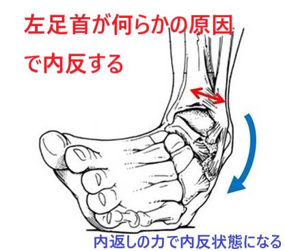 神経痛の予防｜くすりと健康の情報局