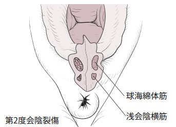 jp2004313690a 性感帯刺激具 - 会 陰