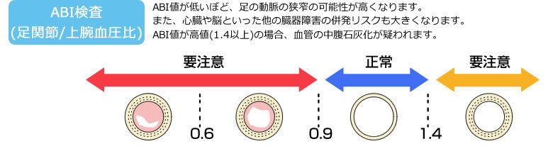 宇都宮市 各種検査 糖尿病専門医