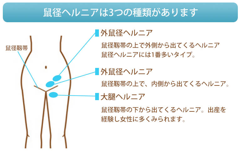 奈良県の鼠径ヘルニア・脱腸の患者さまに当院が選ばれる理由