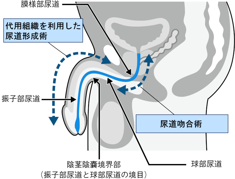 泌尿器科 | 岡山中央病院