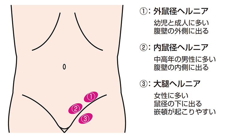 鼠径部とは？（鼠蹊部、鼡径部）《第３回》お客様の為の解剖学｜メンエス講習【愛知/岐阜/三重/名古屋】📕井上教授郎のメンエス大学院📕