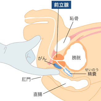 初めてのアナルセックスは準備が大切！気持ちいいやり方と男女の体験談を紹介｜風じゃマガジン