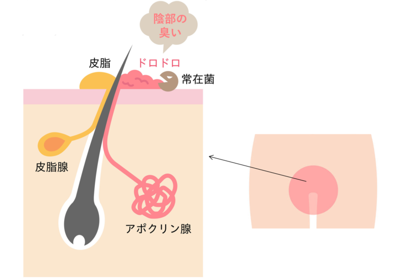 セルフでブラジリアンワックス脱毛は危険？肌への影響は？ | 脱毛サロンアルゴ公式