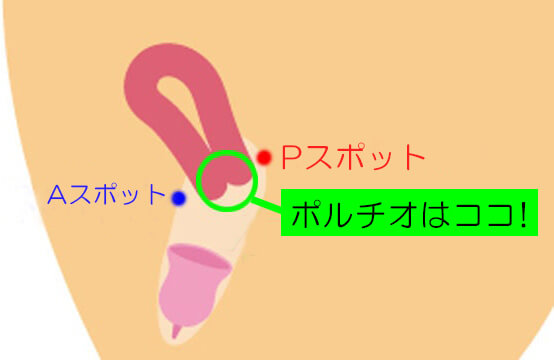 若い女性のその症状、もしや骨盤内炎症性疾患(PID)? - 東京ベイ・浦安市川医療センター