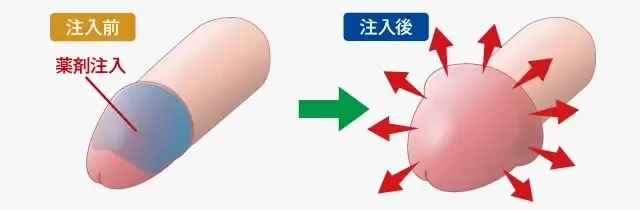 包茎手術・亀頭増大・長茎術｜大阪梅田中央クリニック｜形成外科・泌尿器科・美容外科