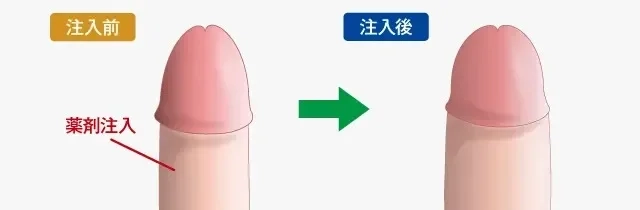 素人映像】「生チンコ…先っぽだけ入れていい？」「少しだけなら///」生姦の交渉成立！フィニッシュは膣内へ発射ｗ【盗撮】 - 動画エロタレスト