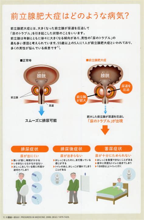 前立腺 マッサージ エロ 動画