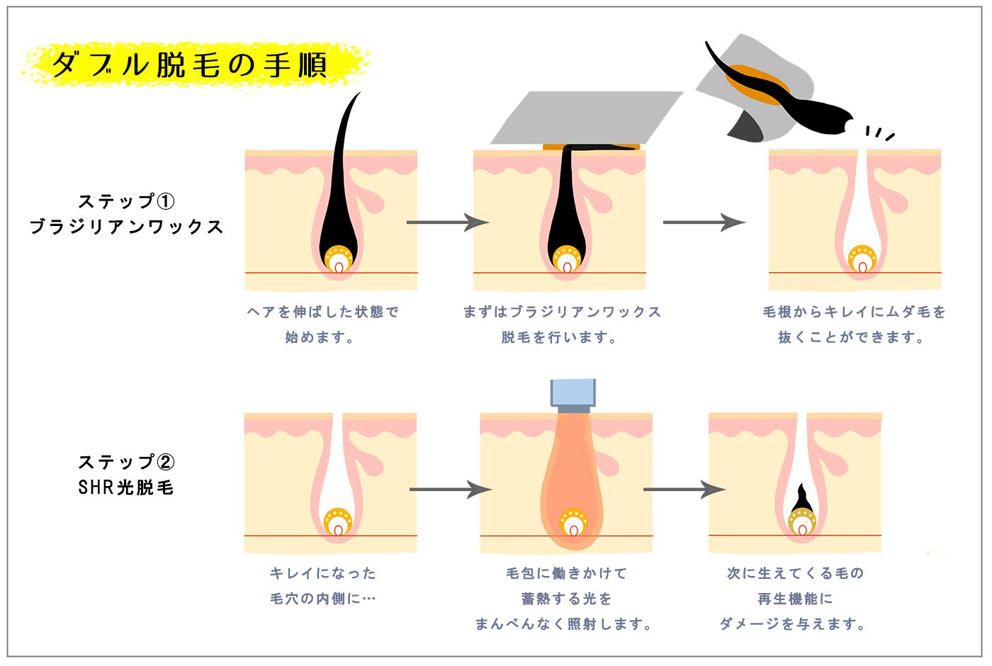 ブラジリアンワックスを続けると毛が薄くなるって本当？ | アンジェリカ コラム