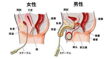 セックスが膀胱炎の原因に？対策と予防法を知ろう