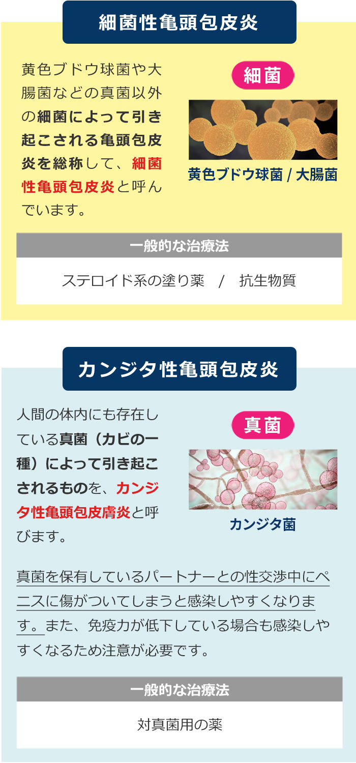 いぼ痔はオロナインで改善する？特徴から見る対策方法について解説 | 漢方生薬研究所