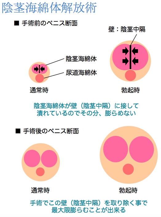 ペニス大きさを男性の外見から一発判断する方法５選【イラスト図解版】 | セクテクサイト