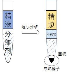 当院の精液処理法 | 幸町IVFクリニック