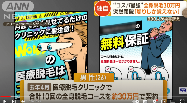 海外発！Breaking News】円形脱毛症で10年間悩み続けた18歳女性、サロンでの施術後に思わず涙（英）＜動画あり＞ - ライブドアニュース