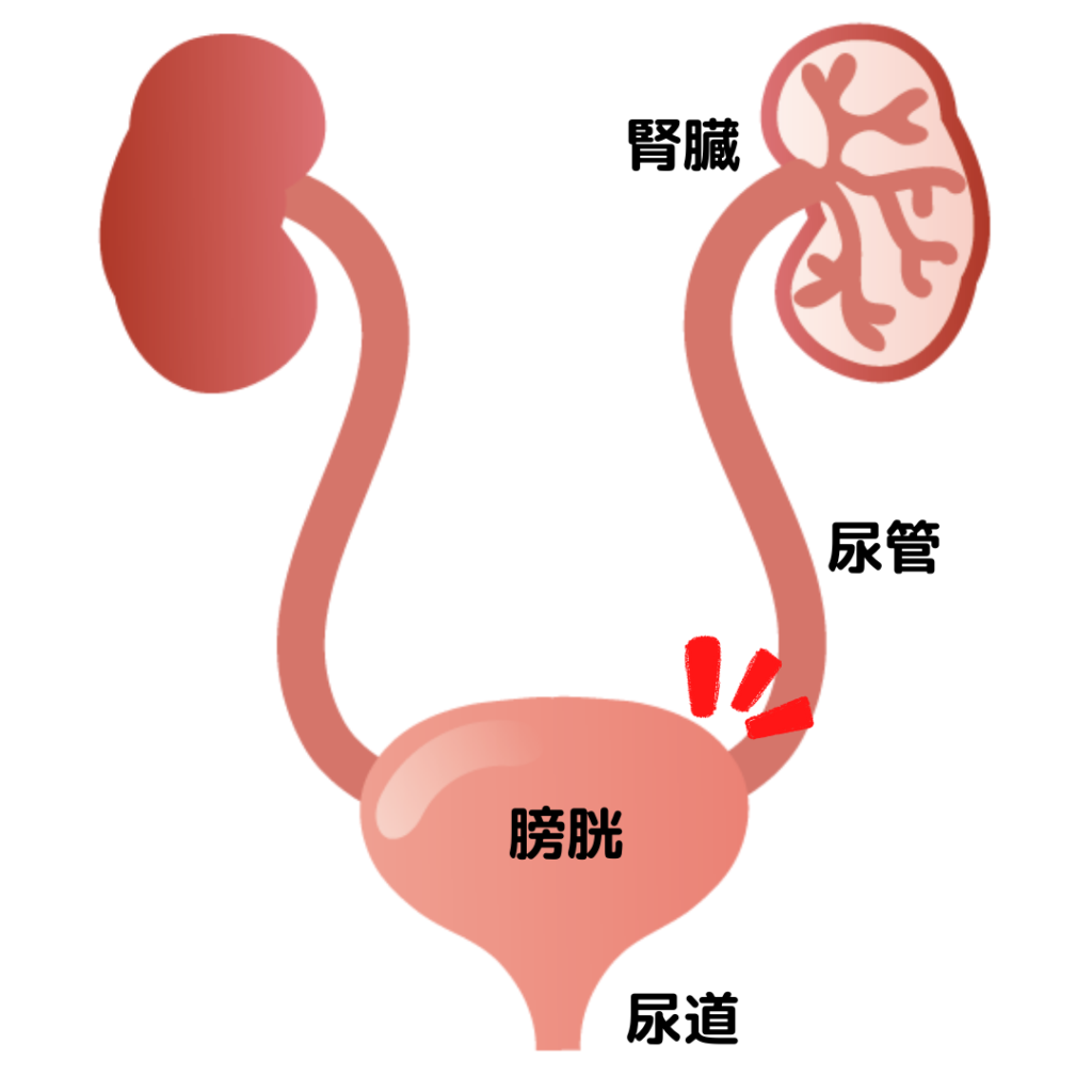 尿が垂れる、その対策（男性編） | こだいら泌尿器科