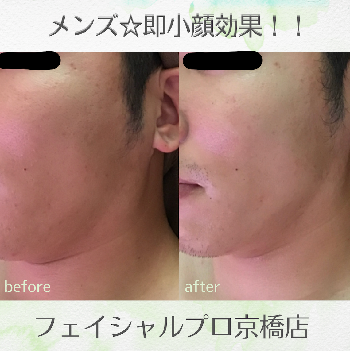 FACIAL BEAUTY TREATMENT（ヒト幹細胞フェイシャルエステ）｜Lovall【ラヴォール】大阪市都島区京橋駅すぐのまつエク＆エステサロン