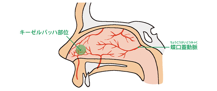 気になる鼻の症状 「鼻血への対処法」 - きょうの健康 -