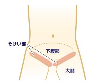 短期集中3日間 日本初！奥義ジャップカサイ「睾丸マッサージ」を学ぶ |