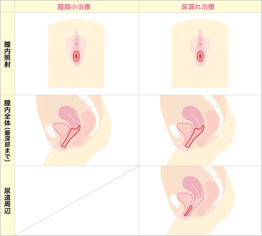 【TENGA】膣圧測定器でテンガの膣圧を測定した結果やっぱり凄かった！