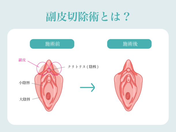 婦人科形成 | 美容外科、婦人科形成の東京のモティーフ銀座クリニック