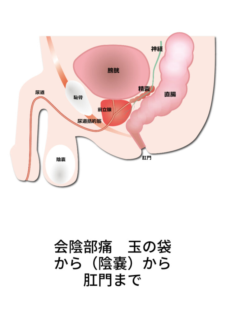 尿管ステントによる症状とその対処方法