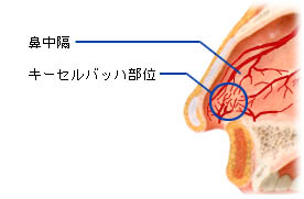 鼻血が出た！どうすればいい！？もしかして深刻な病気！？耳鼻咽喉科医がお答えします。（前田陽平） - エキスパート - Yahoo!ニュース