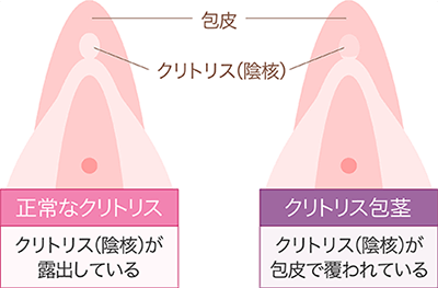 クリトリスの皮を剥くコツは？クリイキするための正しい剥き方をイラストでチェック