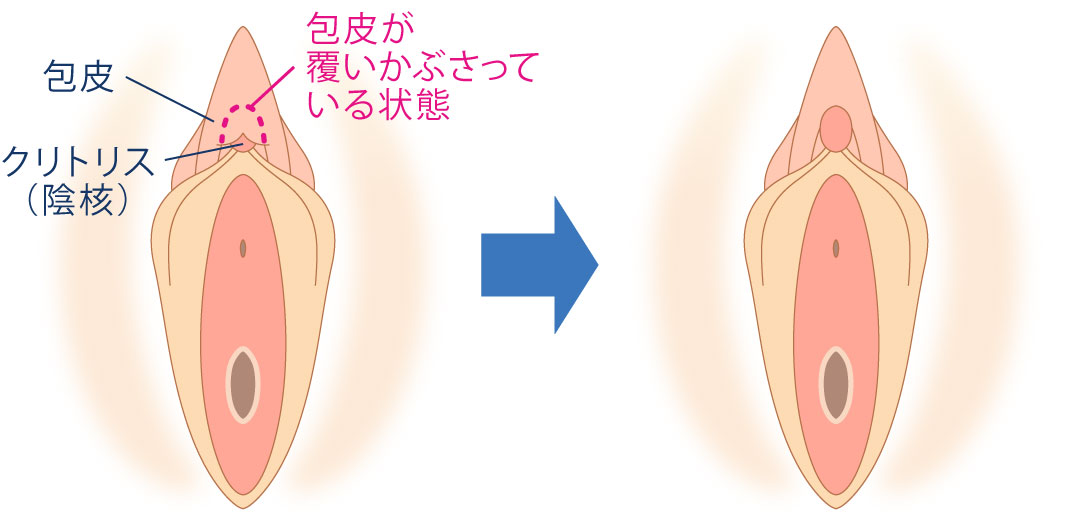 女性の性感帯とは？ 感じやすい場所を知ってセルフプレジャーやセックスをもっと楽しく ｜ iro iro