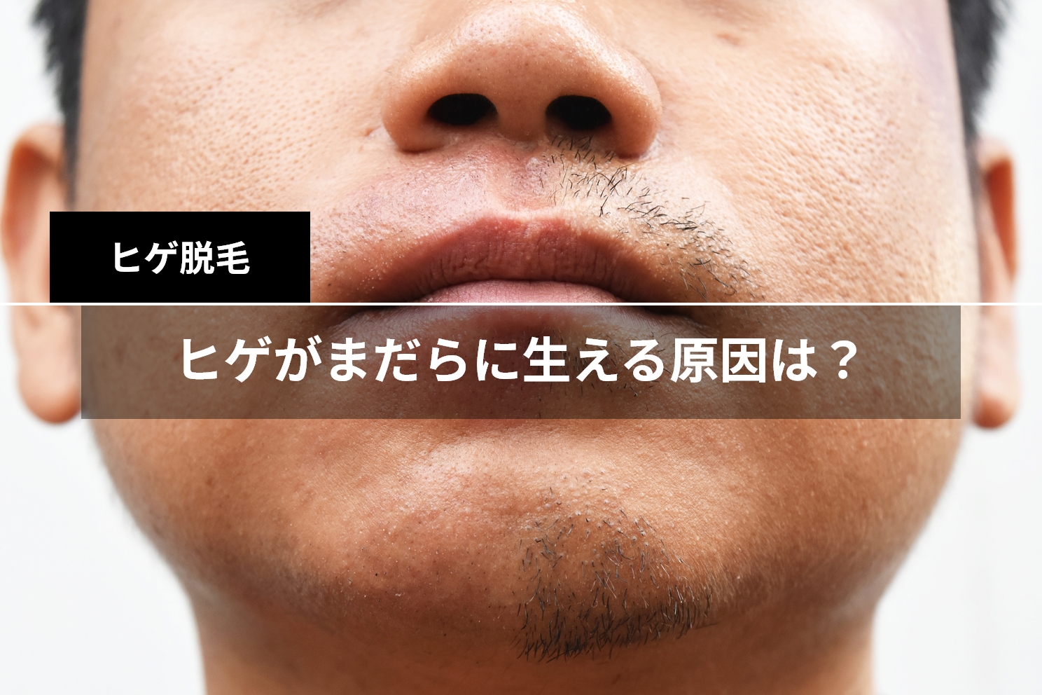 濃い髭（ヒゲ）を薄くするポイントとは？髭が濃い原因と対策について - 【公式】メンズトータルエステサロン ZELMO(ゼルモ)