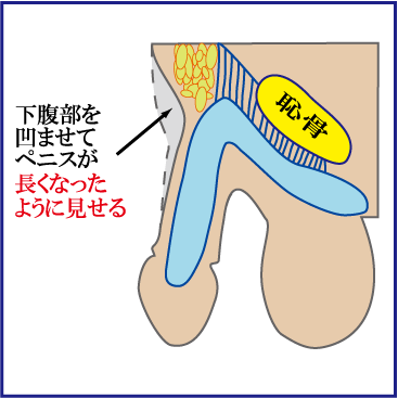 【医師が解説】〇〇が長いとペニスが大きい!? #Shorts