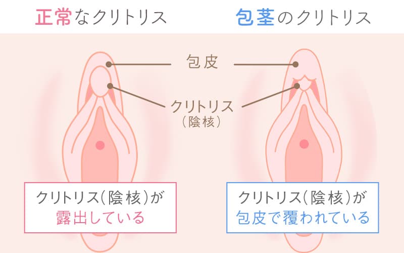 クリトリスは快感を得るための臓器であることを知っていましたか？