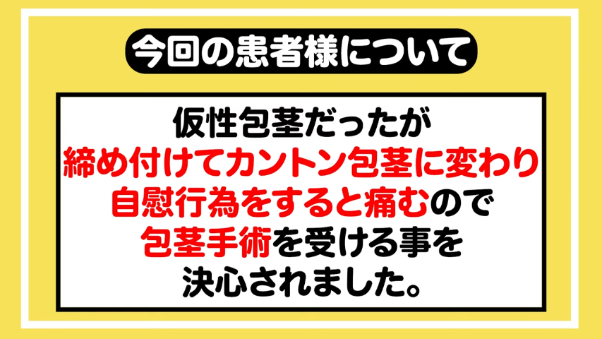 女性はオナニーしている？ イクためのやり方・グッズも紹介【医師監修】 ｜ iro iro