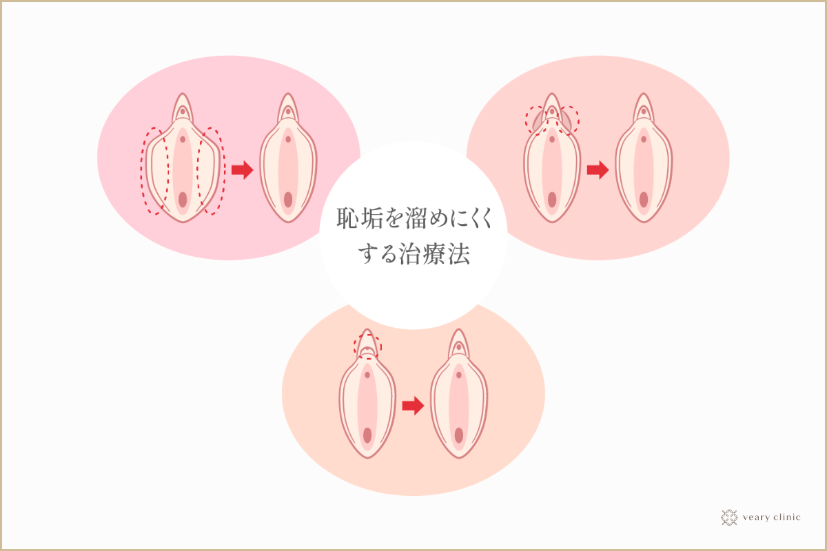 ペニスや陰嚢など、男性器の色が年々黒くなっていくのが気になります…【専門医が回答！男性の体Q&A⑨】 | yoi（ヨイ）