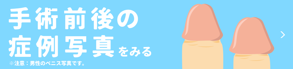 亀頭包皮炎｜神戸市東灘区 摂津本山｜いしむら腎泌尿器科クリニック