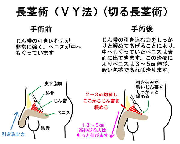 山形 クリニック │ おすすめメンズクリニック20院！料金が安い・施術内容も比較