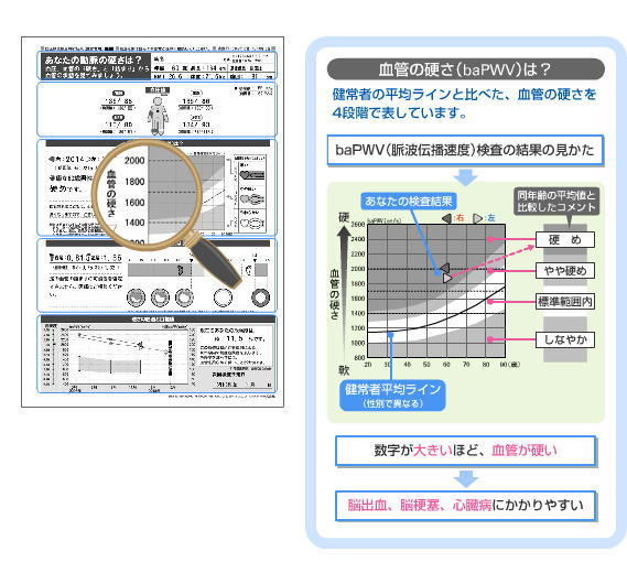 CAVI（キャビィ検査）｜動脈硬化net フクダ電子