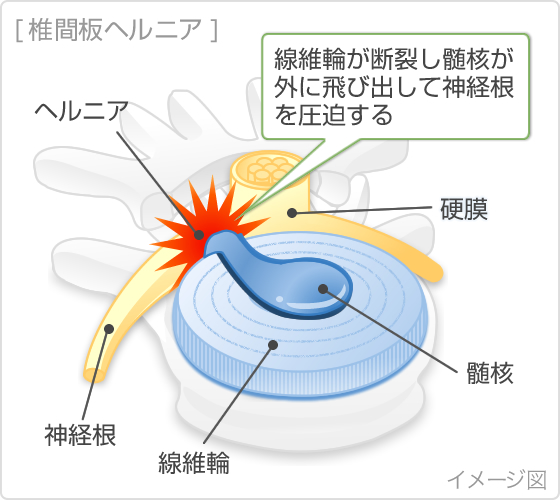 耳鳴り、腰痛や左肩の痛みで困っていた患者さんの声 | 大阪市鶴見区の整体なら【快生整骨院・カイロプラクティック院】