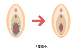 もしかしてゆるい？膣圧のチェックとトレーニング方法まとめ | スキンケア大学