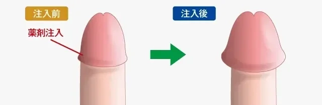 【チントレ】AV男優しみけんのチ〇トレは凄かった!!