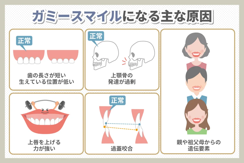 ワイテルズ スマイル受け