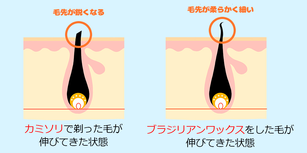 ブラジリアンワックスを使った脱毛とは？メリットとデメリットをご紹介 | mismos（ミスモス）