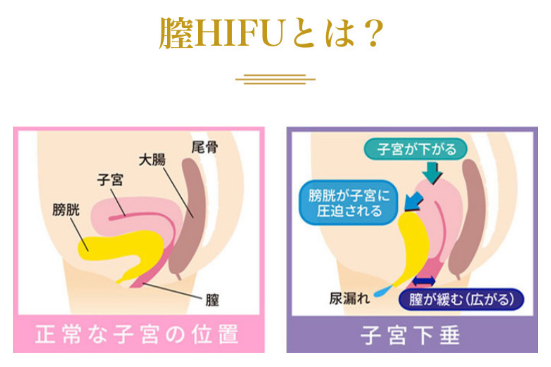 自分の「しまり」を数字で知ろう！膣圧測定について | コラム一覧｜ 東京の婦人科形成・小陰唇縮小・女性器形成・包茎手術・膣ヒアルロン酸クリニック