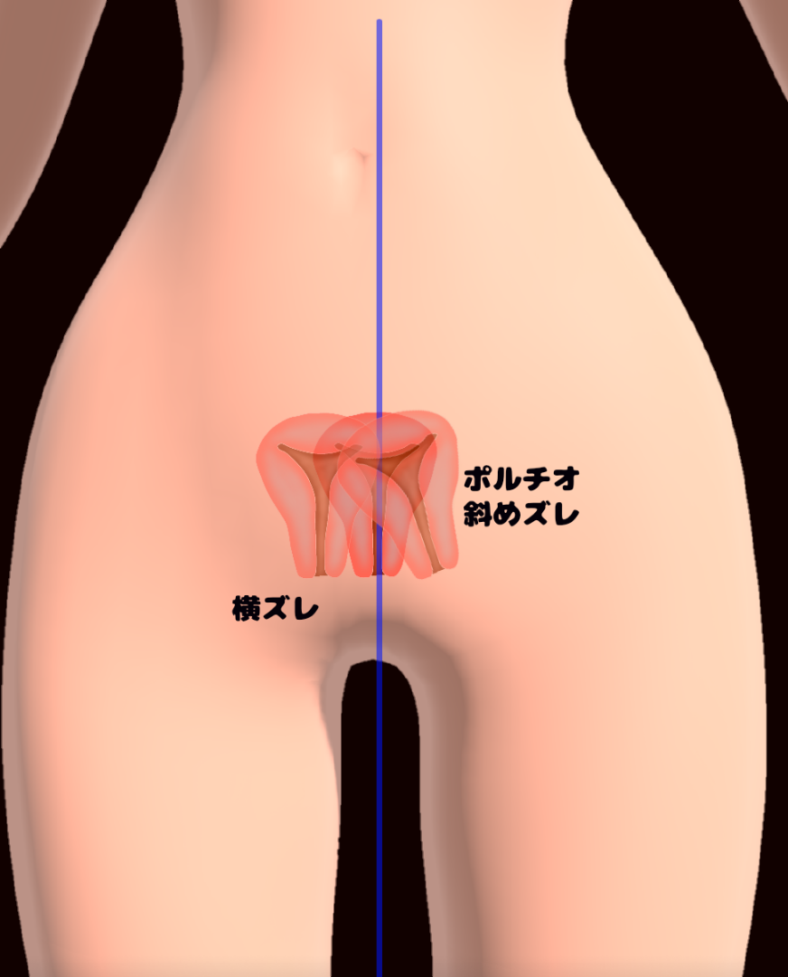 膣ケア・膣トレはデリケートゾーンの不調に効果的！初心者もできる基本方法｜wakanote